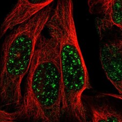 MAST3 Antibody, Novus Biologicals 25 &mu;L; Unlabeled:Antibodies, Polyclonal